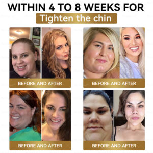 BuildLeaf® GLP-1 Slimming & Health Nano Microneedle Patch