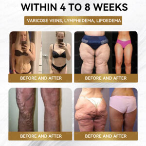 BuildLeaf® GLP-1 Slimming & Health Nano Microneedle Patch
