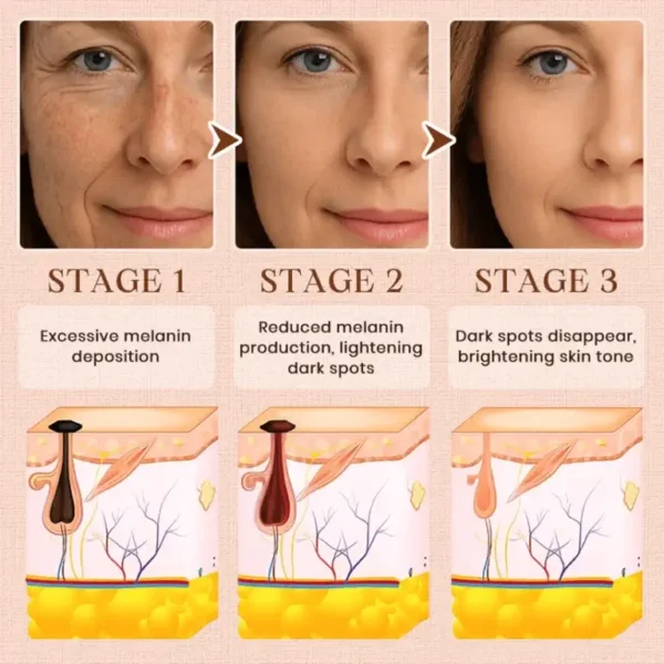 Luhaka®️ Purifying Exfoliating Gel for Acanthosis Nigricans
