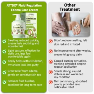 ATTDX® Fluid Regulation Edema Care Cream
