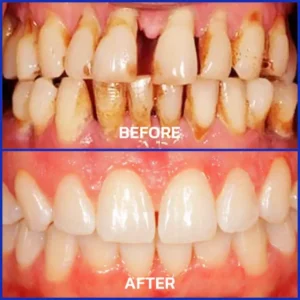 Rolimey® VioCore Bee Venom Dental Treatment Toothpaste