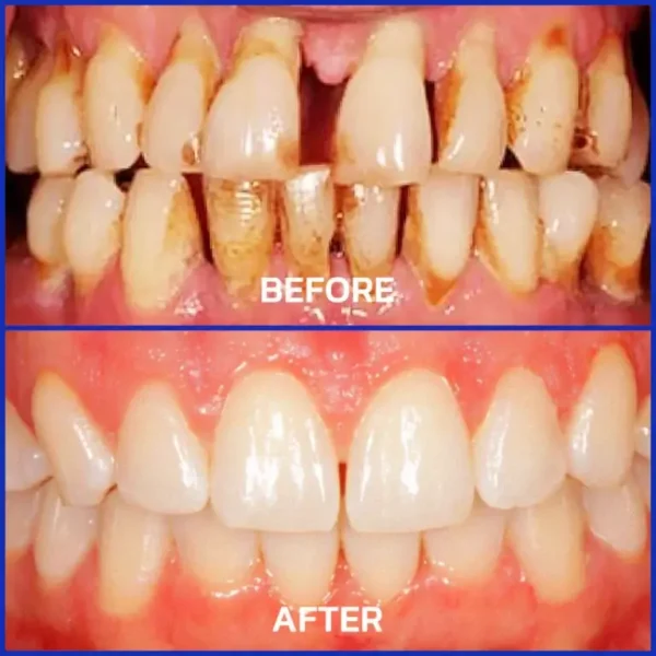 Rolimey® VioCore Bee Venom Dental Treatment Toothpaste