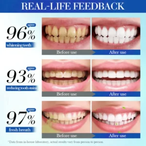 AQA™ Hydroxyapatite Toothpaste 7.5% for Enamel Repair