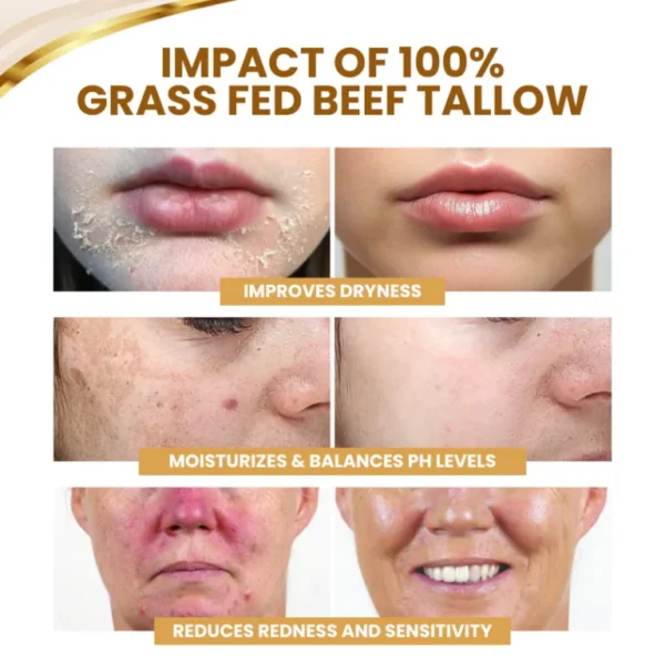 Timilk® DermSerene Beef Tallow Honey Balm