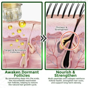 flysmus® Microneedle Herbal Infusion Hair Stimulation Set